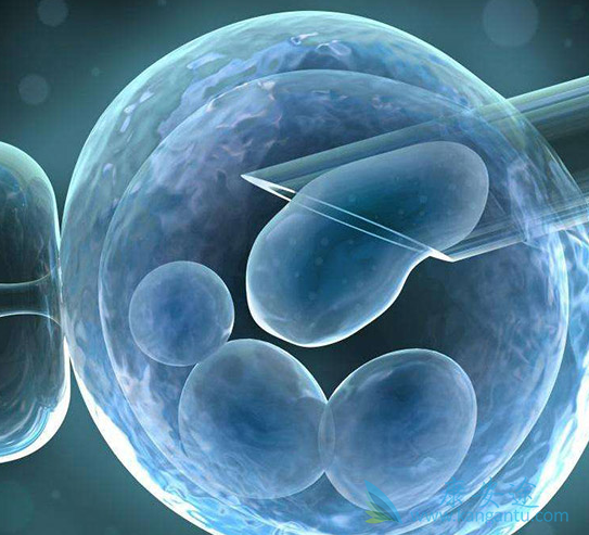 俄罗斯试管婴儿 俄罗斯试管婴儿