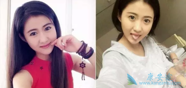 最美癌症女孩 最美癌症女孩