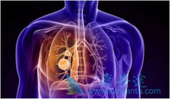 肺癌的治疗方法 肺癌的治疗方法