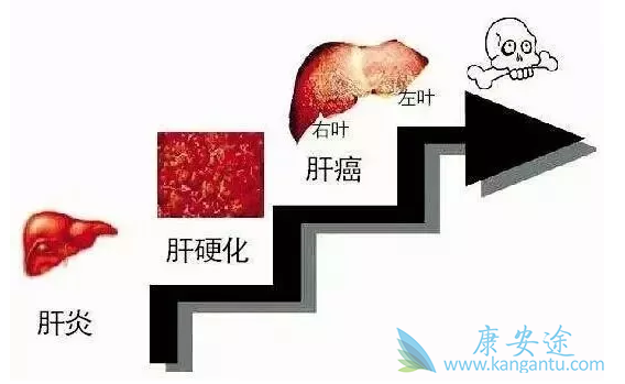 乙肝症状 乙肝症状