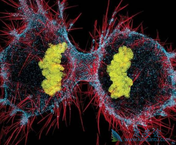 癌症遗传吗 癌症遗传吗