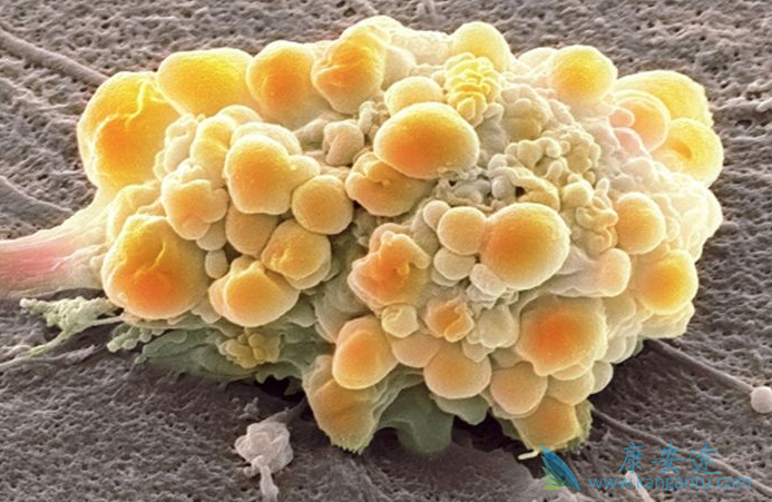 得了癌症怎么办 得了癌症怎么办