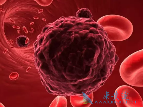 癌症症状 癌症症状