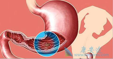 消化道肿瘤 消化道肿瘤