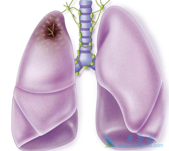 �ΰ����ڻᴫȾ��