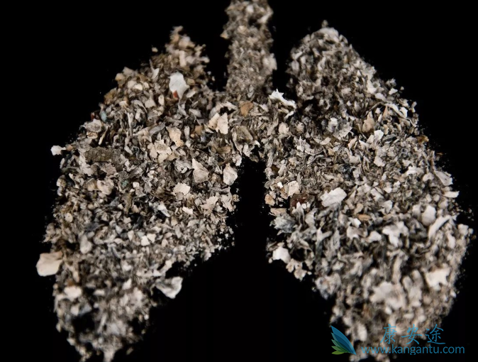 小细胞肺癌生存期 小细胞肺癌生存期