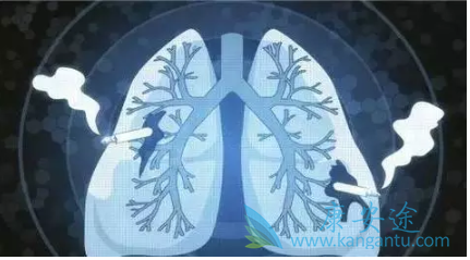 晚期肺癌治疗 晚期肺癌治疗