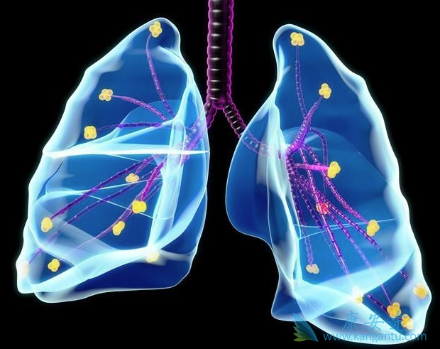 肺癌生物治疗 肺癌生物治疗