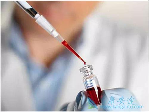 古巴肺癌疫苗 古巴肺癌疫苗