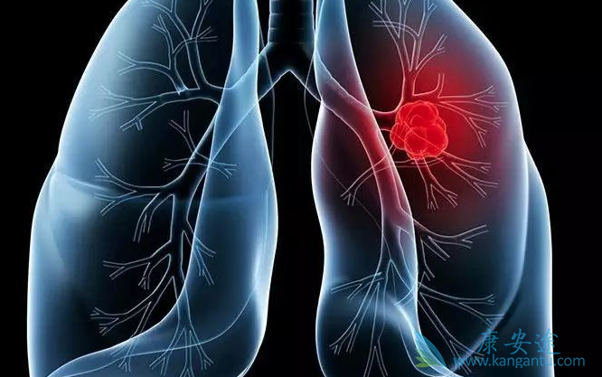 肺癌的治疗方法 肺癌的治疗方法