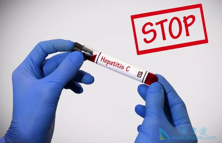 治疗丙肝要多少钱 治疗丙肝要多少钱