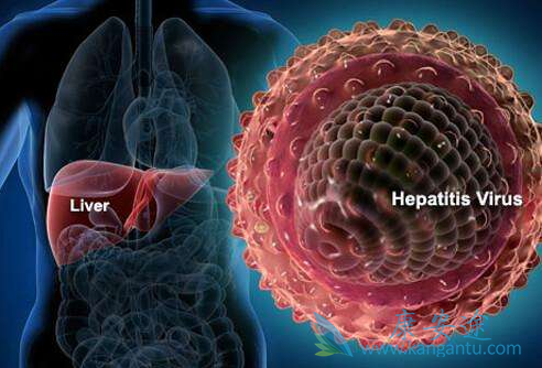 丙肝能治好吗 丙肝能治好吗