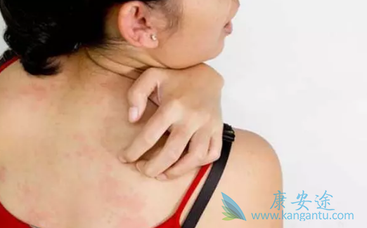 乙肝症状 乙肝症状