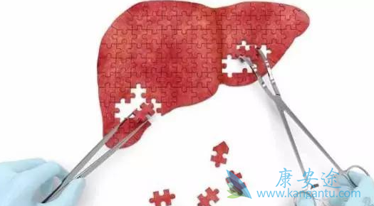 丙肝好治吗 丙肝好治吗