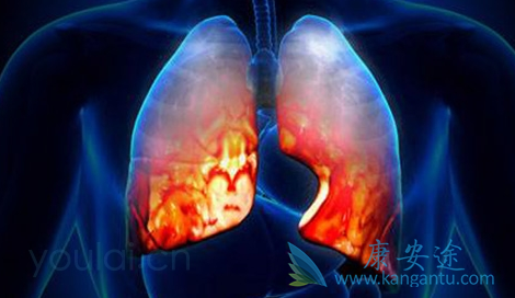 小细胞肺癌 小细胞肺癌