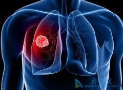 ��Сϸ���ΰ�������Ӧ����ȡ�ۺ�����廯�������ϵ�ԭ��