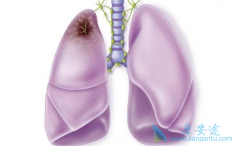 ���߳��ַΰ���Ѫ֢״ʱӦ������ҽ