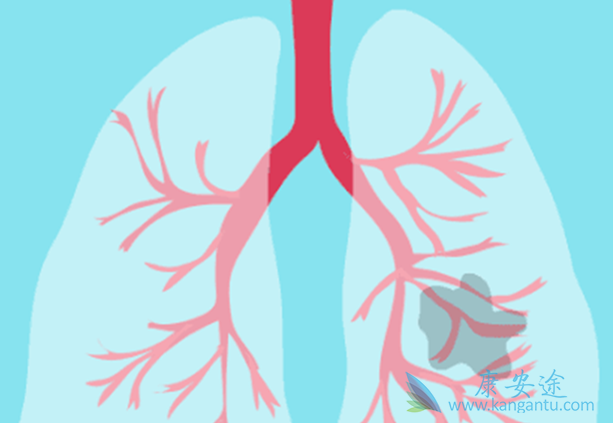 肺癌放疗 肺癌放疗