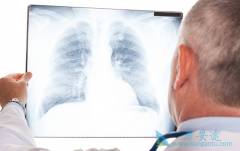 ���ڷΰ�����ѡ��PD-1�������ϻ���Ч������