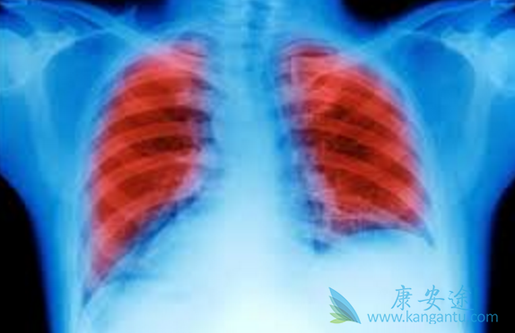 肺癌中晚期能活多久 肺癌中晚期能活多久