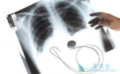 ���������Ƿ�Сϸ���ΰ����ڻ�����Ч�����Ʒ���