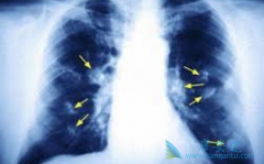 �ΰ����κ��𣿷ΰ����������Ʒ�������Щ��