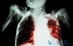 �ΰ����������κ������Ʒΰ���������Щ��