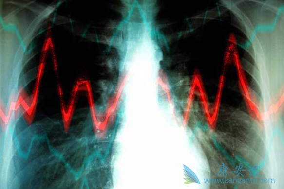 晚期肺癌 晚期肺癌