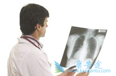 非小细胞肺癌 非小细胞肺癌