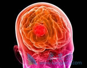 出国看病 出国看病