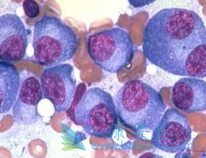 ʲô�Ƕ෢�Թ�����