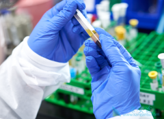 CAR-Tϸ�����Ʒ�����Ҫ��ȡ���ߵ�ѪҺ�������Tϸ��