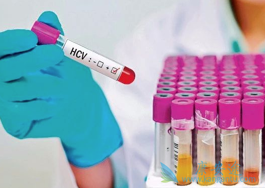 怎样治丙肝 怎样治丙肝