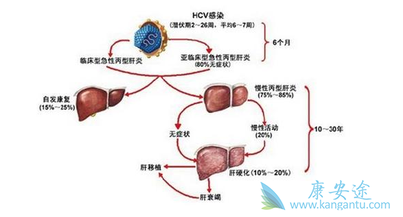 治疗丙肝要多少钱 治疗丙肝要多少钱