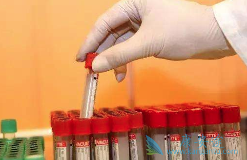 伏立诺他 伏立诺他