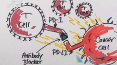 NKϸ������PD-1���Ƽ��ܴ����������Ʒ�����Ч��