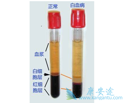 ��Ѫ��������