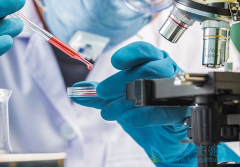 CAR-Tϸ�����ƿ�������ʵ������CAR-T�Ʒ���ʵ������Ч����