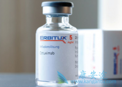 �������������������Ը���TP53Ұ����ֱ��������PFS��OS