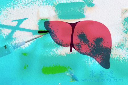 丙肝传染吗 丙肝传染吗