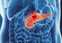 �������ٰ�֢״���ֺ��������ٰ��ķ���