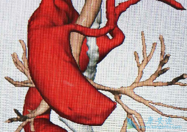 尼妥珠单克隆抗体 尼妥珠单克隆抗体