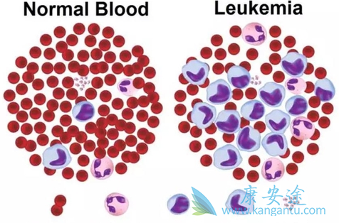 ��Ѫ���Ŵ���