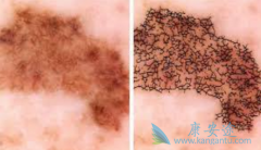 ��ɫ�����������������Щ��PD-1���������ƺ�ɫ������