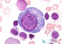 ʲô�ǹ��������쳣�ۺ��������������쳣�ۺ������Ʒ�������Щ��