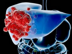 �ΰ���������Ч���ò��ã��÷������������ڸΰ�������