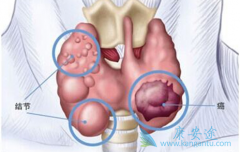 ��״�ٰ������ܻ��ã��������Ԥ����״�ٰ�������