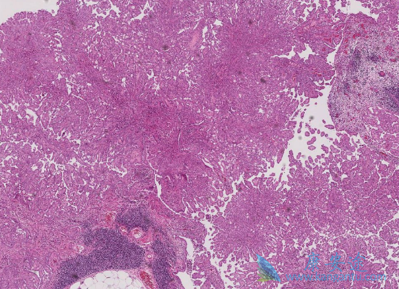 ���Լ�Ƥ��