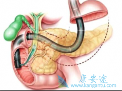 Ϊ���������ٰ�Ч�����Щ�����׻����ٰ�