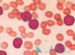 ��Ѫ�������в�����Ⱦ����Ҫ������